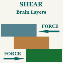 Shear between layers of the brain