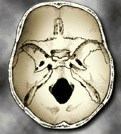 Interior of Skull