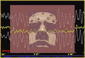 EEG