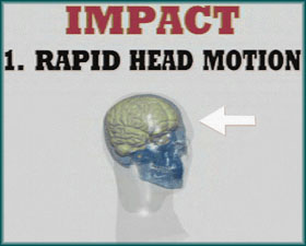 Rapid Head Motion