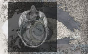 Imaging Studies