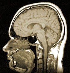 MRI
