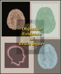 Objective Evidence