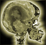 Skull